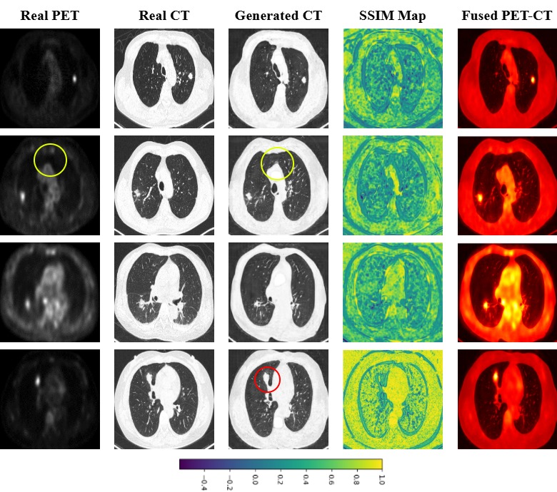 petct_pcgan.jpg